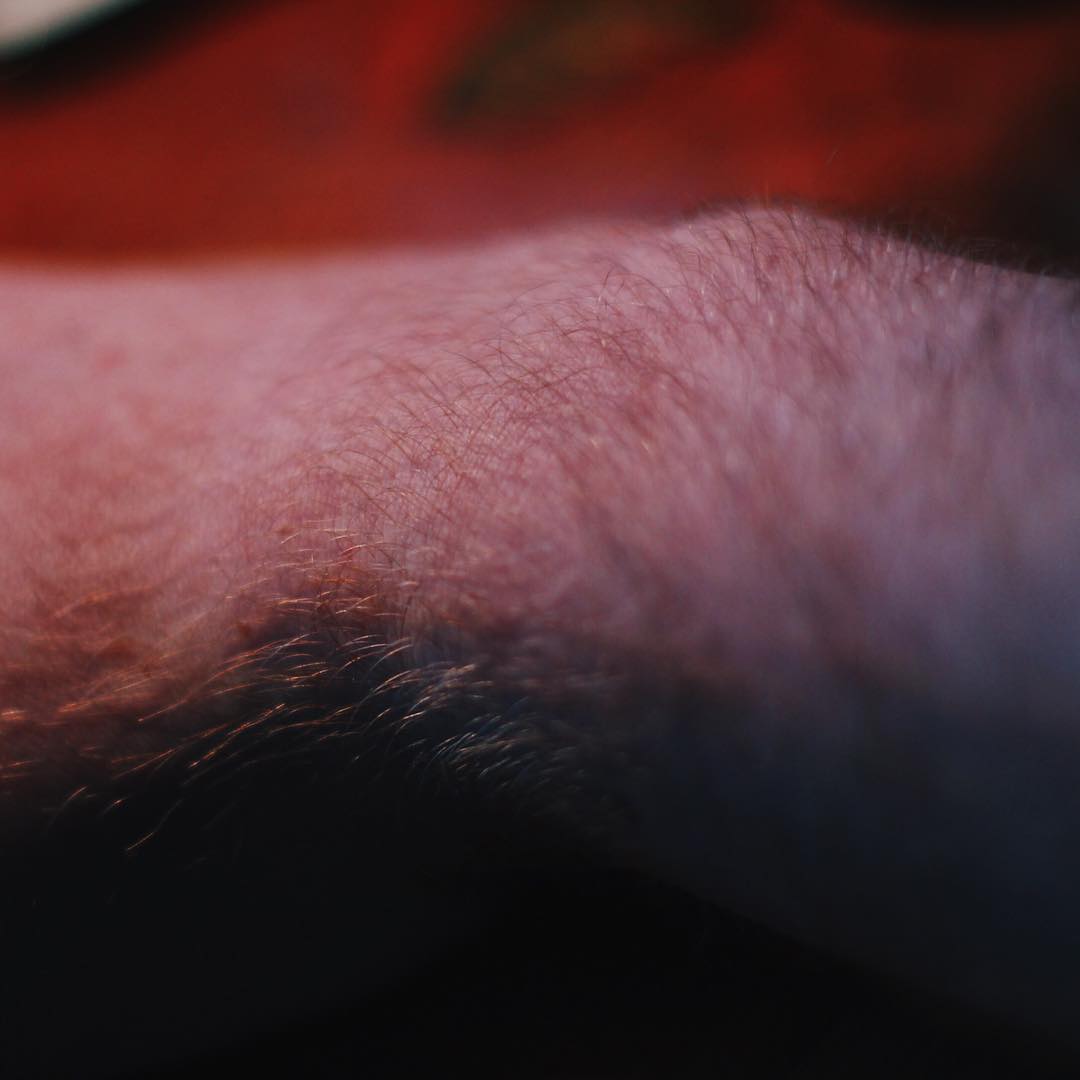 Carpal Tunnel Pain ⚡️⚡️